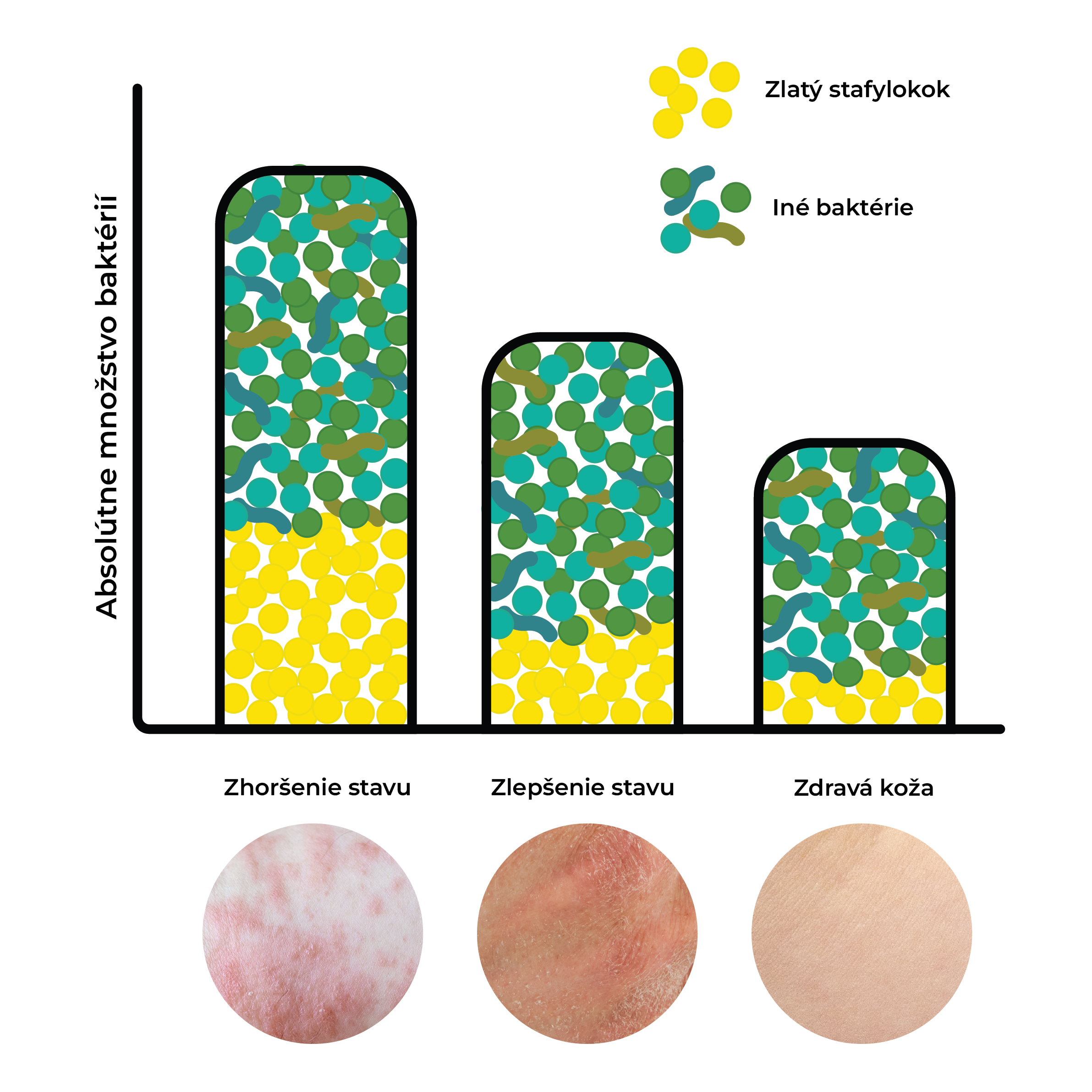 stafylokok na pokožce